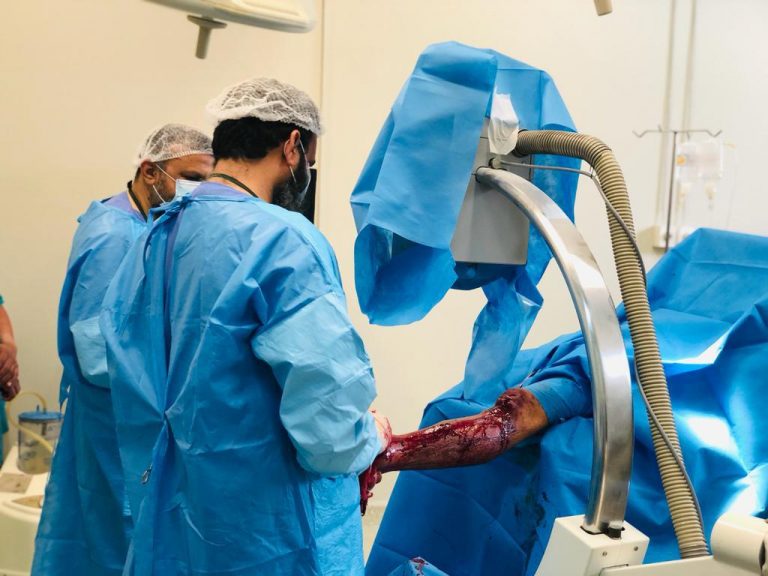 First ever Inter-Locking Nail Tibia Surgery performed at Khairpur Civil Hospital