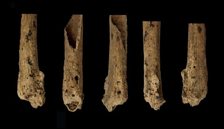 Photo of Prehistoric child’s amputation is oldest surgery of its kind