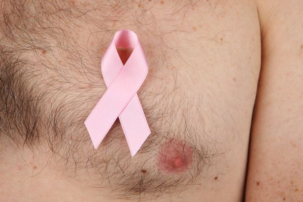 Around 350 men are diagnosed with male breast cancer each year in the UK