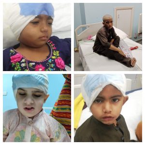Children under treatment after operation